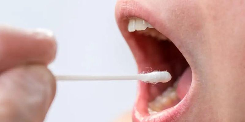 How to Overcome Cotton Mouth